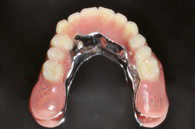 Chirurgia e implantologia dentale: materiali e accessori